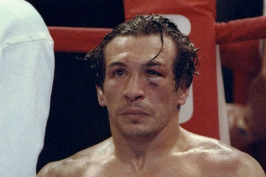 «Вторая голова выросла». 20 лет одной из самых жутких травм в боксе. Фото